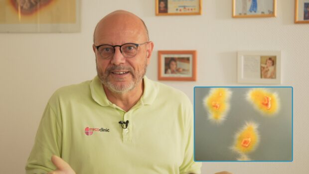 Dermatomykose bei Kindern